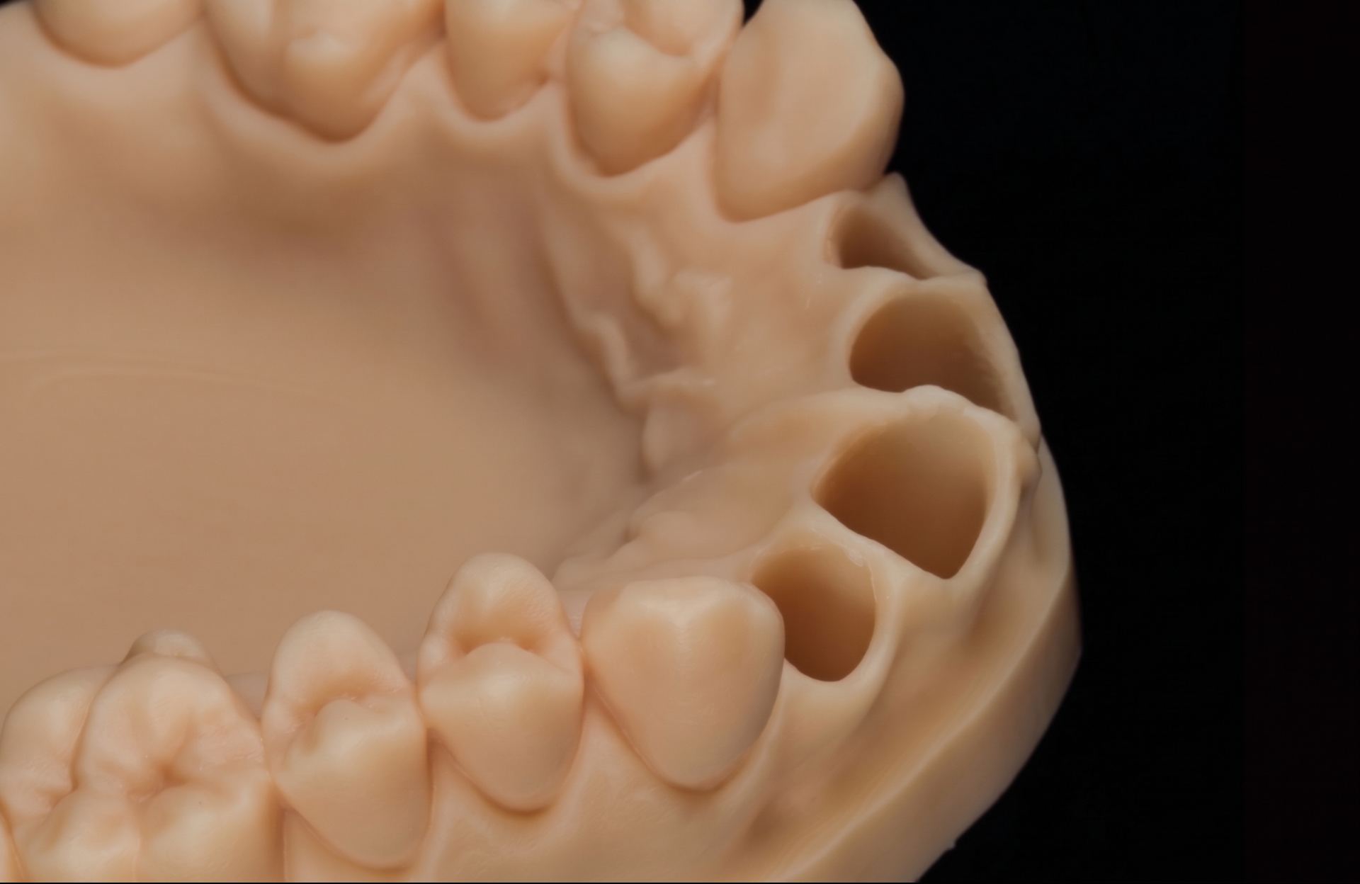 SPLINT_DENTAL__1__6a82939f49aa1.jpg