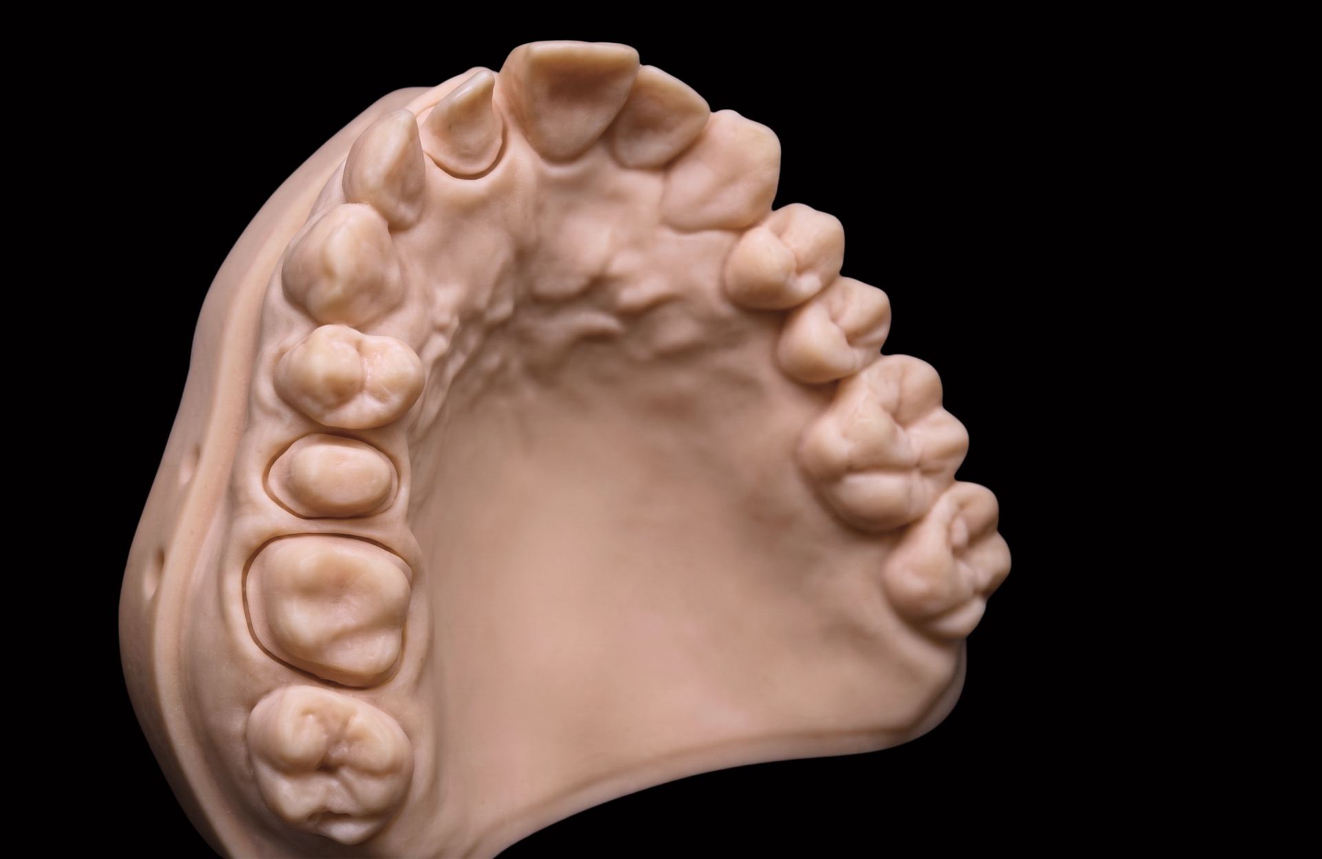 SPLINT_DENTAL__5__6a8295953905a.jpg
