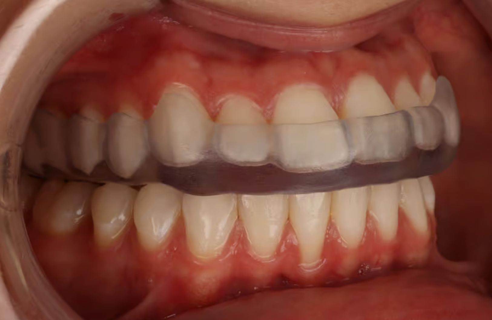 spfl2_6a84c0f1764c6.jpg
