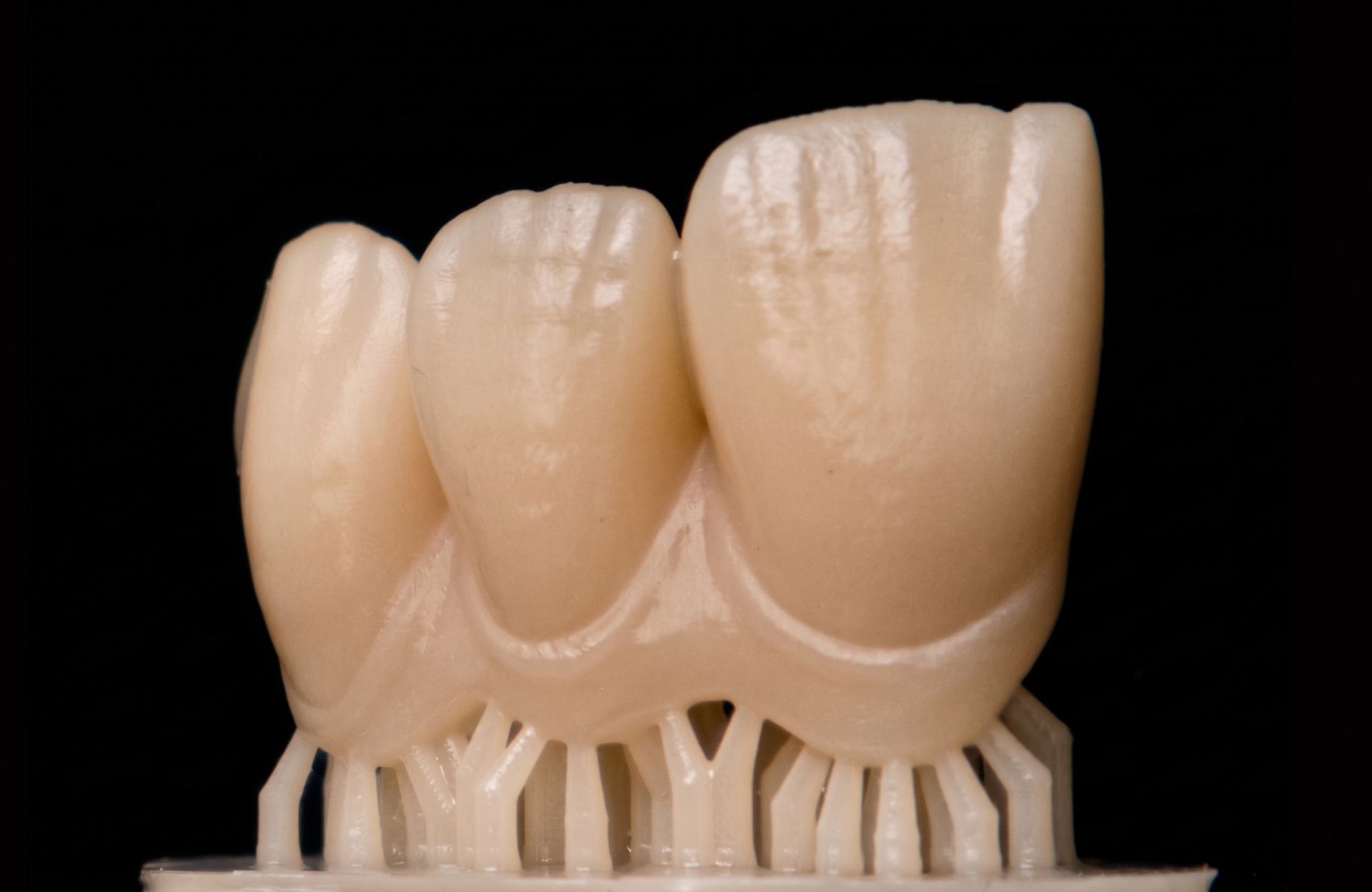 SPLINT_DENTAL__8__6a83e91958f6c.jpg